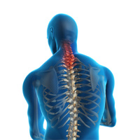 Neck Strains and Sprains