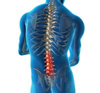 Lumbar Spinal
