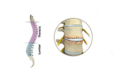 Thoracic Spine Anatomy